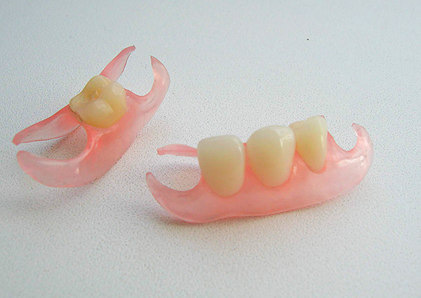 Временные зубные протезы