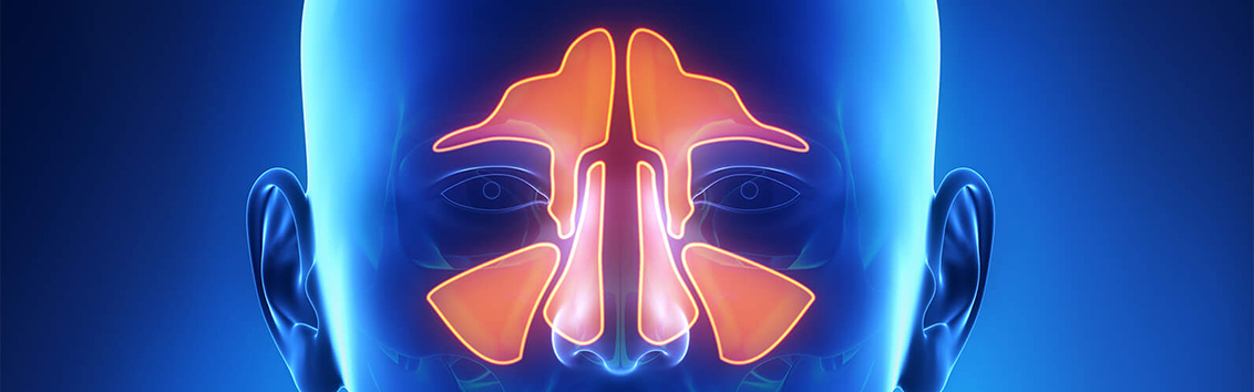 Компьютерная томография пазух носа