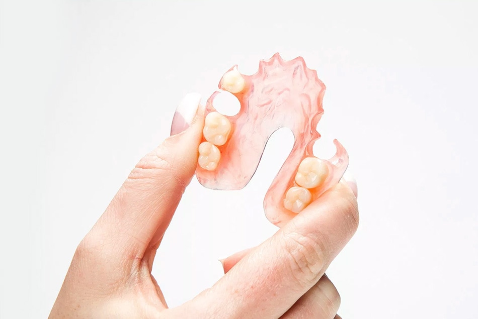 Почему надо ставить протез на место удаленного зуба?