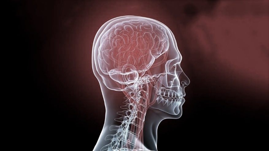 Компьютерная томография головы и шеи