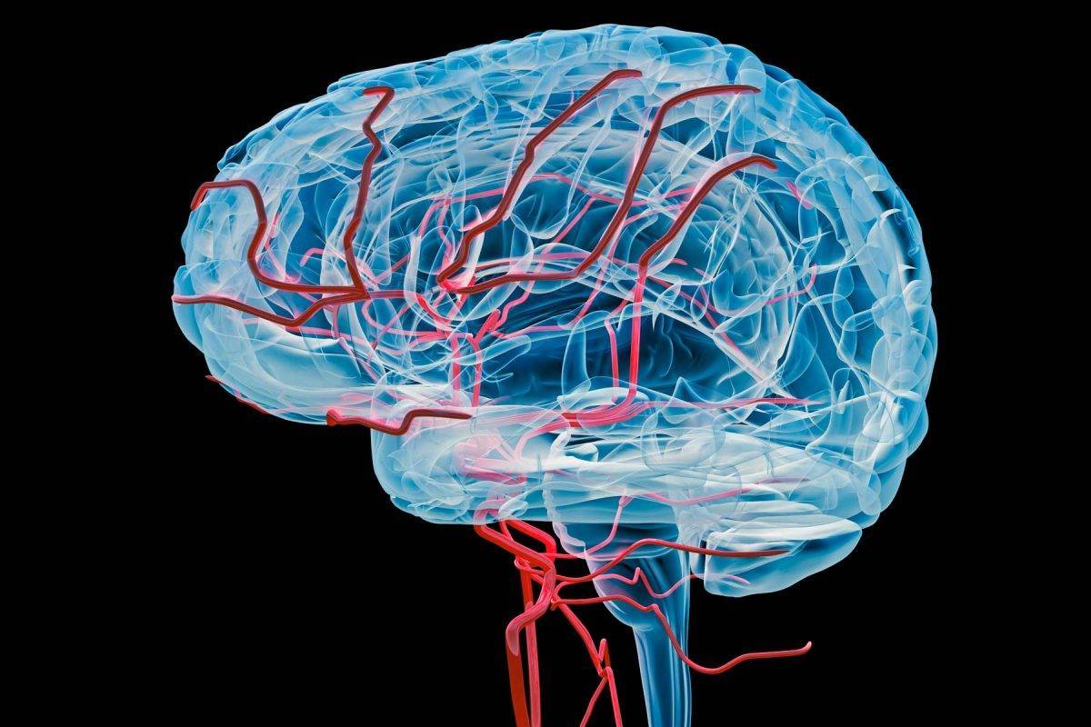 Компьютерная томография сосудов головного мозга